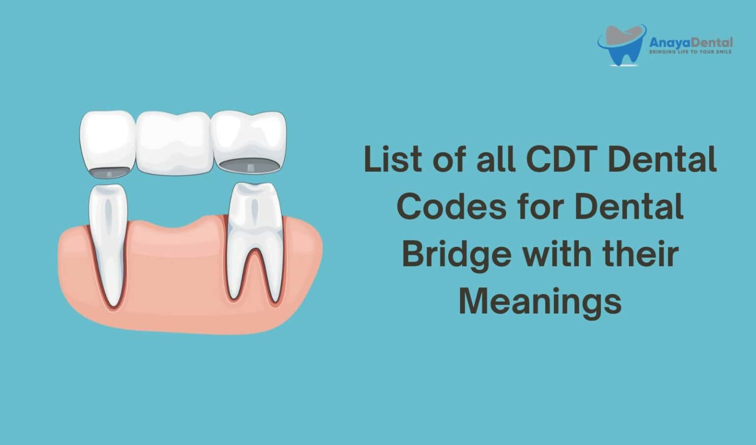 List Of All Cdt Dental Codes For Bridges And Their Meanings Anaya Dental