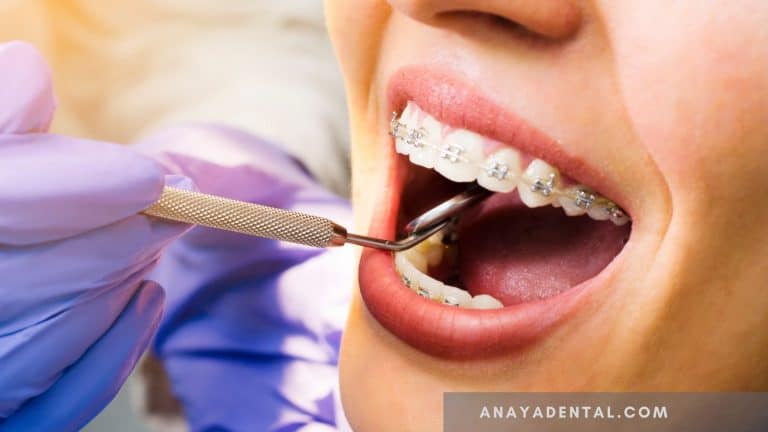 What Are The Complications Of Wisdom Tooth/third Molar Surgery
