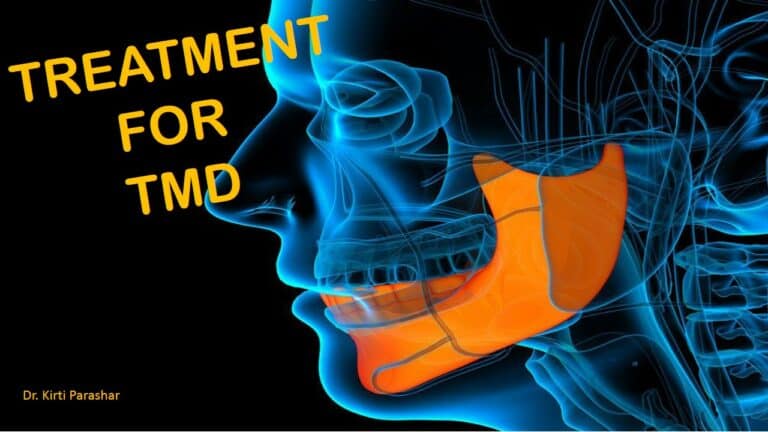 Treatment for TMD