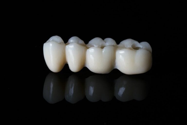 Before and After: Temporary Dental Crown & Bridge Pictures