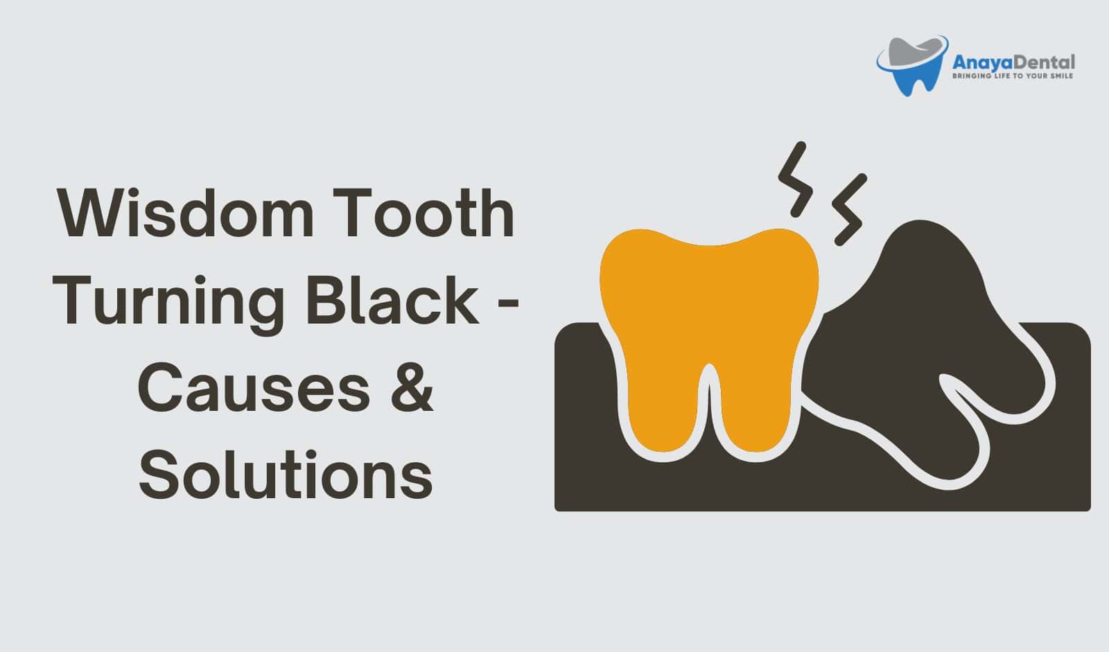 Why Is My Wisdom Tooth Black? Causes and Solutions - Anaya Dental