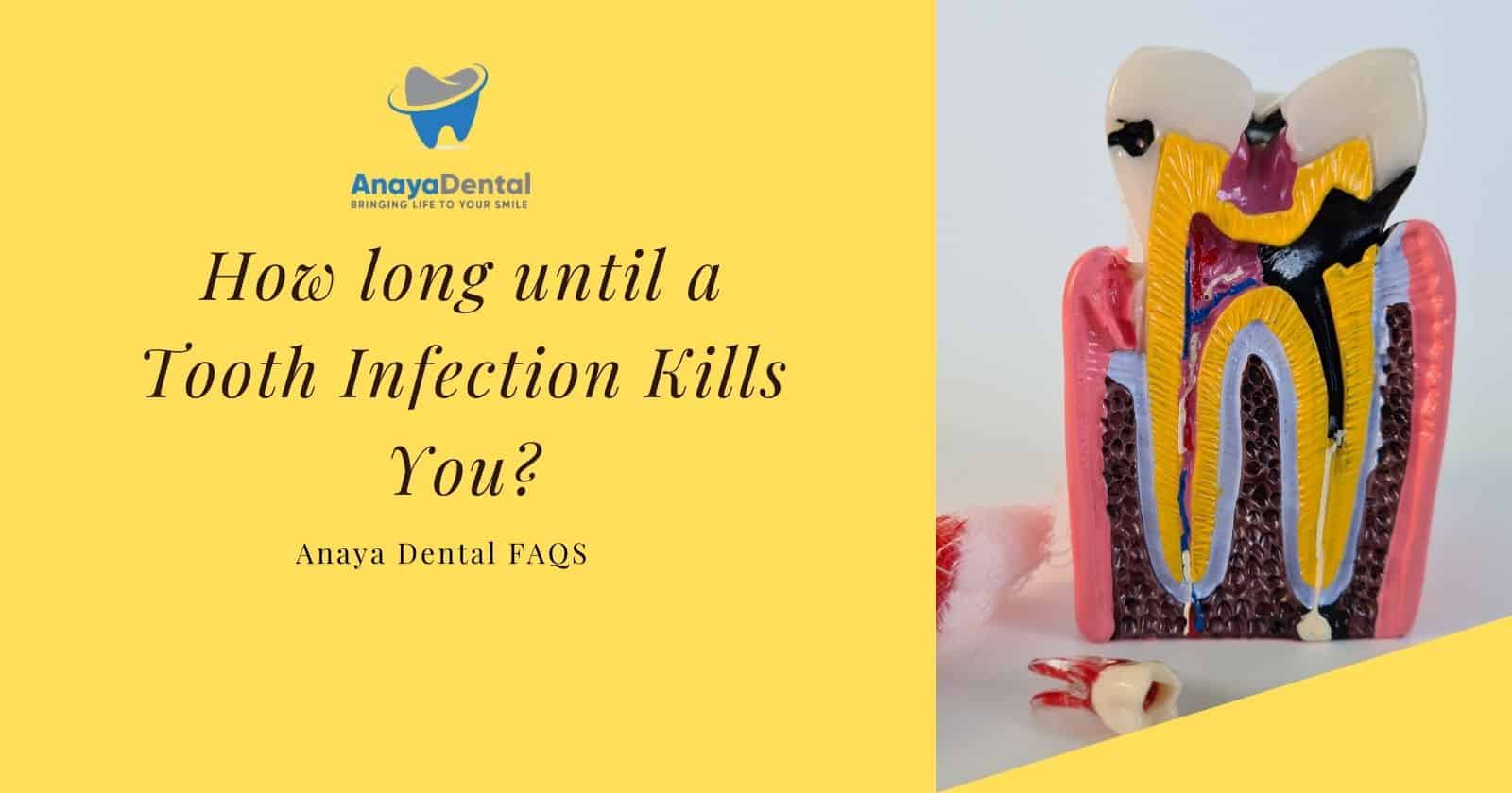 How long until a tooth infection kills you