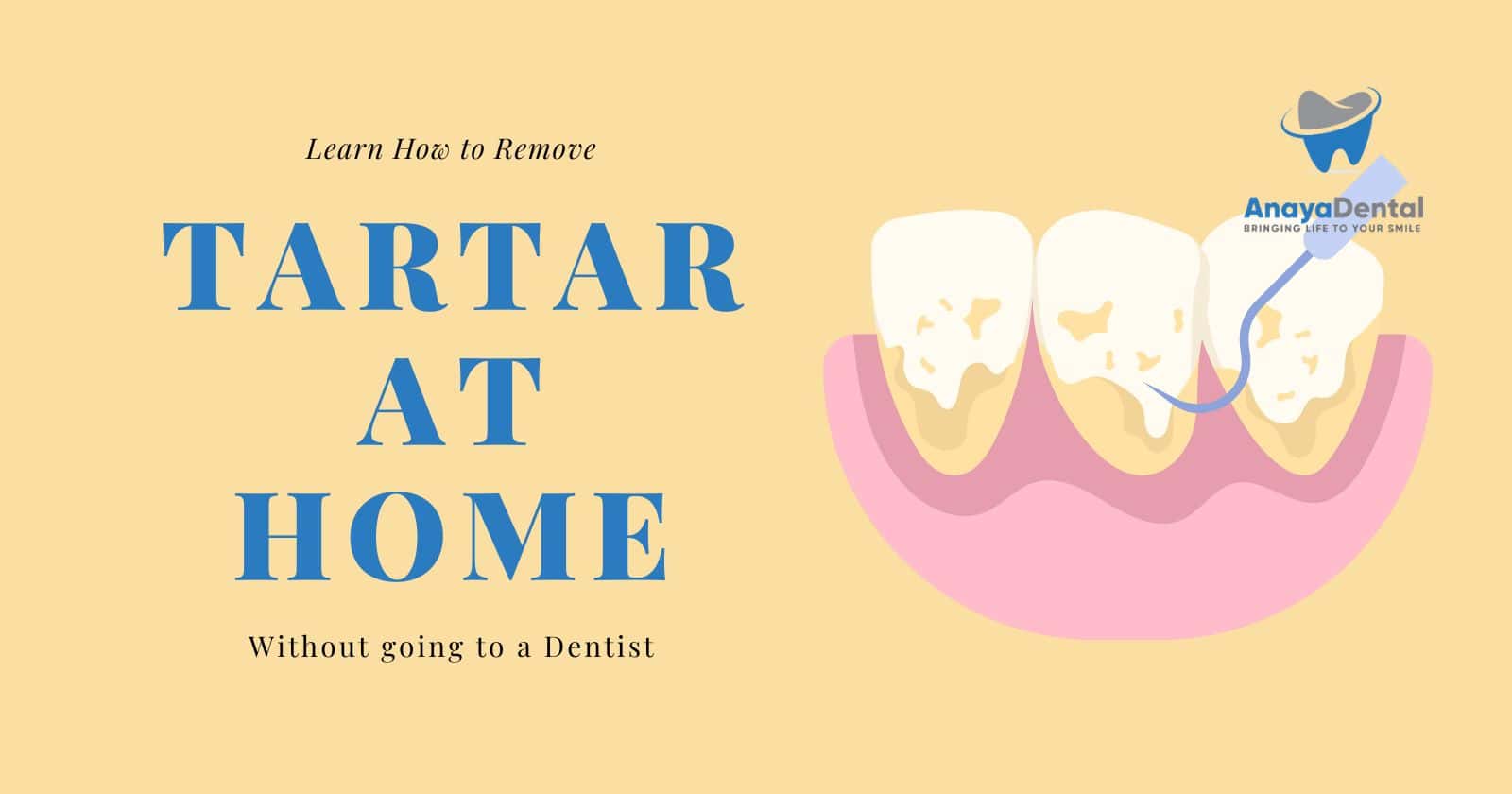 Removing Tartar at home