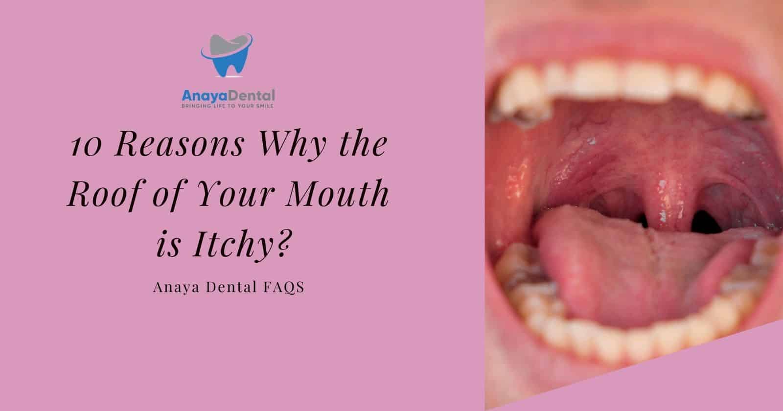 itchy roof of the mouth