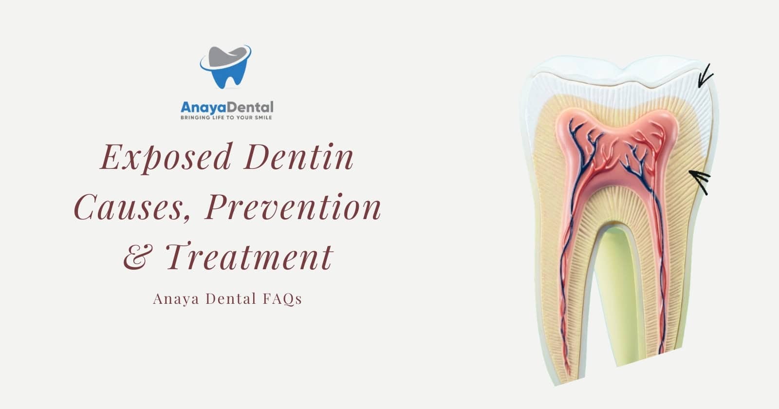 Exposed Dentin Causes, Treatment & Prevention