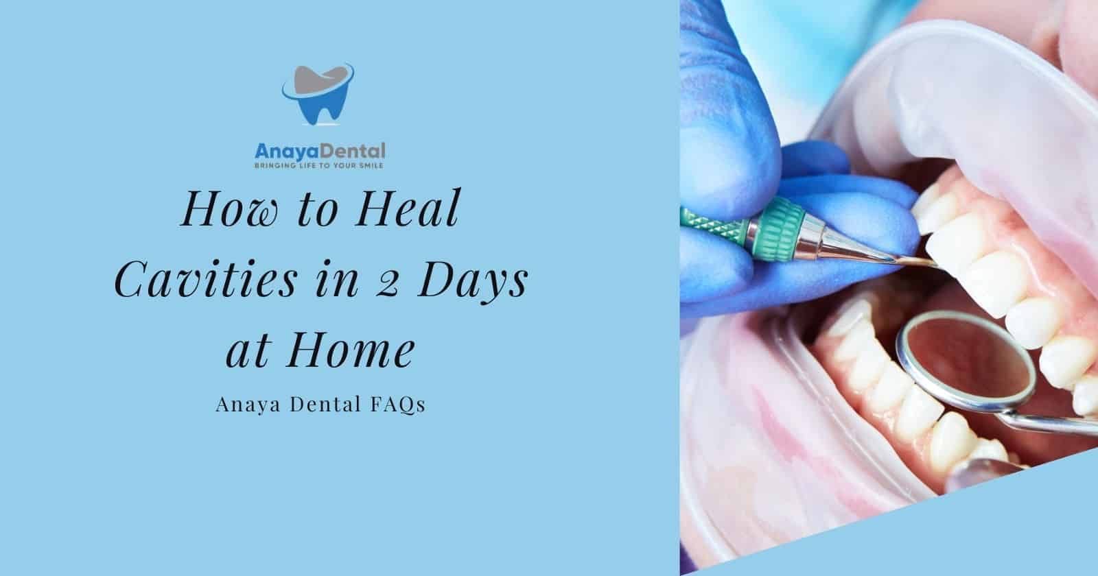 How to Heal Cavities in 2 Days at Home