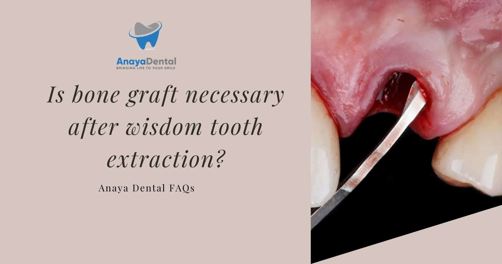 Is bone graft necessary after wisdom tooth extraction