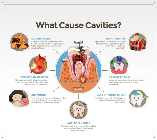 Primary Reasons for Tooth Cavities