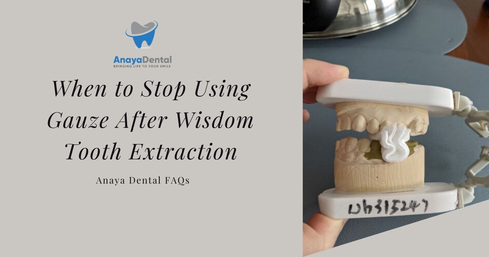 When to Stop Using Gauze After Wisdom Tooth Extraction