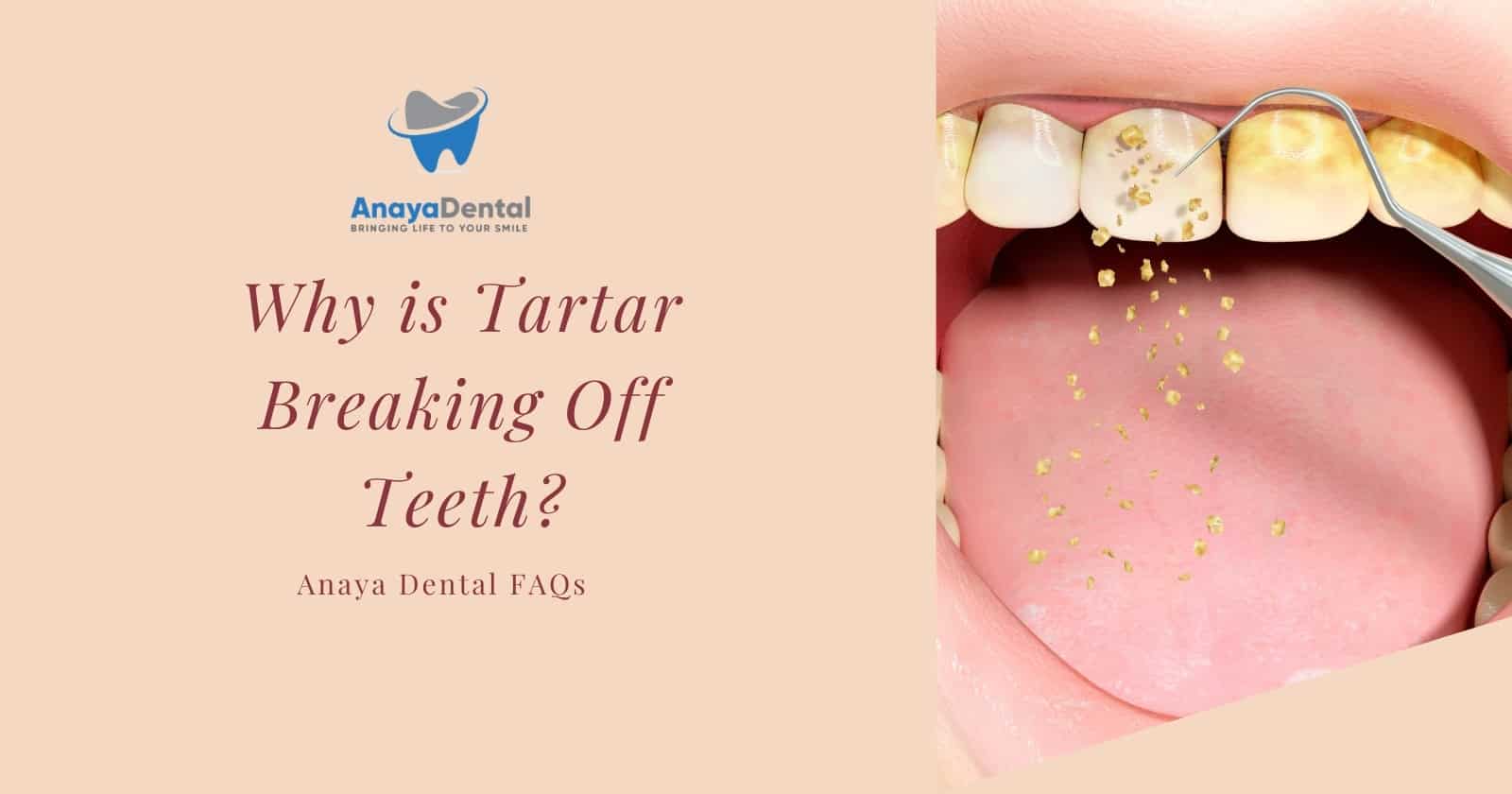 Why is Tartar Breaking Off Teeth?