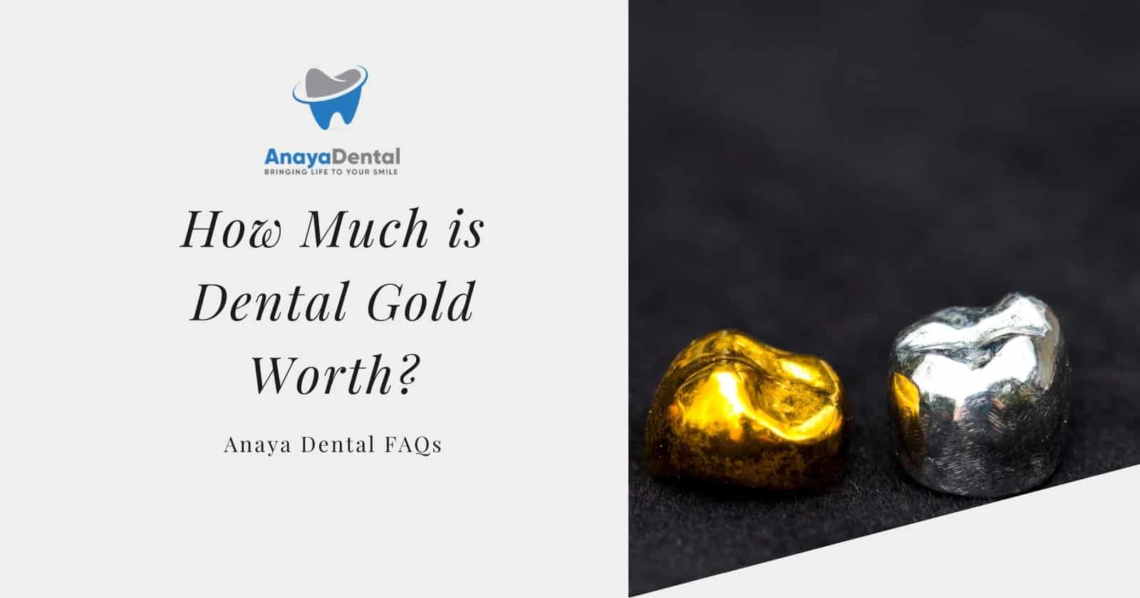 How Much is Dental Gold Worth